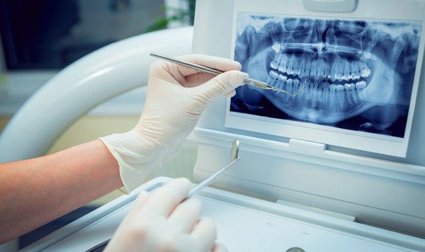 About Facets Dental